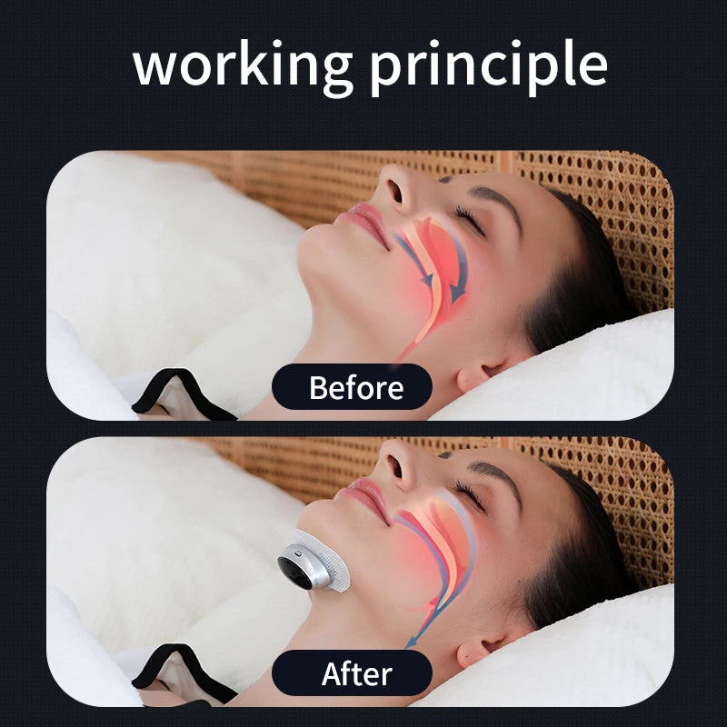 Smart Anti-Snoring Devices Magnetic Anti Snore EMS Easy Breathe Improve Sleeping Aid Apnea Guard Night Device Dropshipping
