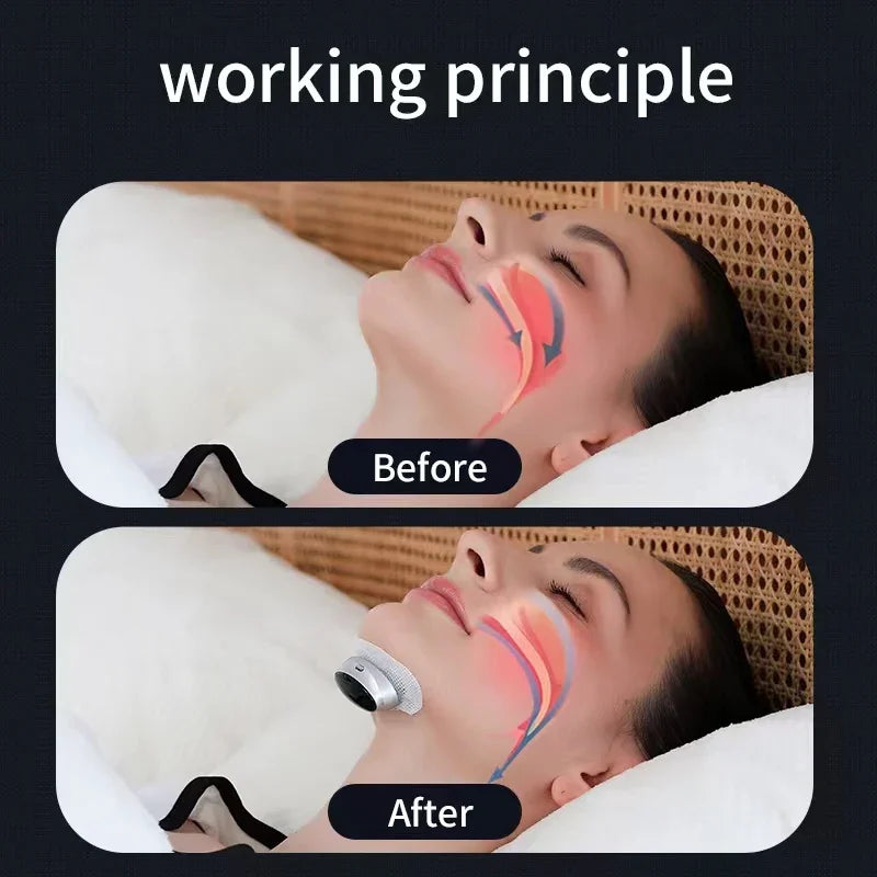Smart Anti-Snoring Devices Magnetic Anti Snore EMS Easy Breathe Improve Sleeping Aid Apnea Guard Night Device Dropshipping